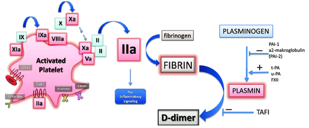 Never ignore extremely elevated D-dimer levels: they are specific for serious illness