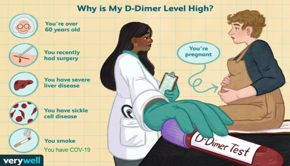 What Is the D-Dimer Test?