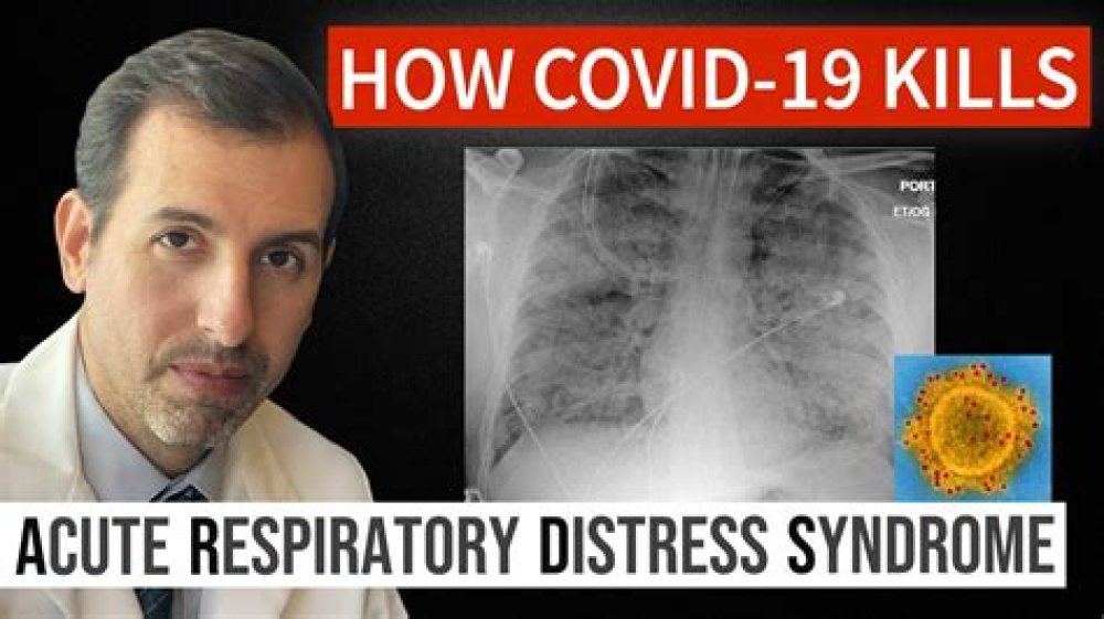 Acute Respiratory Distress Syndrome and COVID-19: A Scoping Review and Meta-analysis