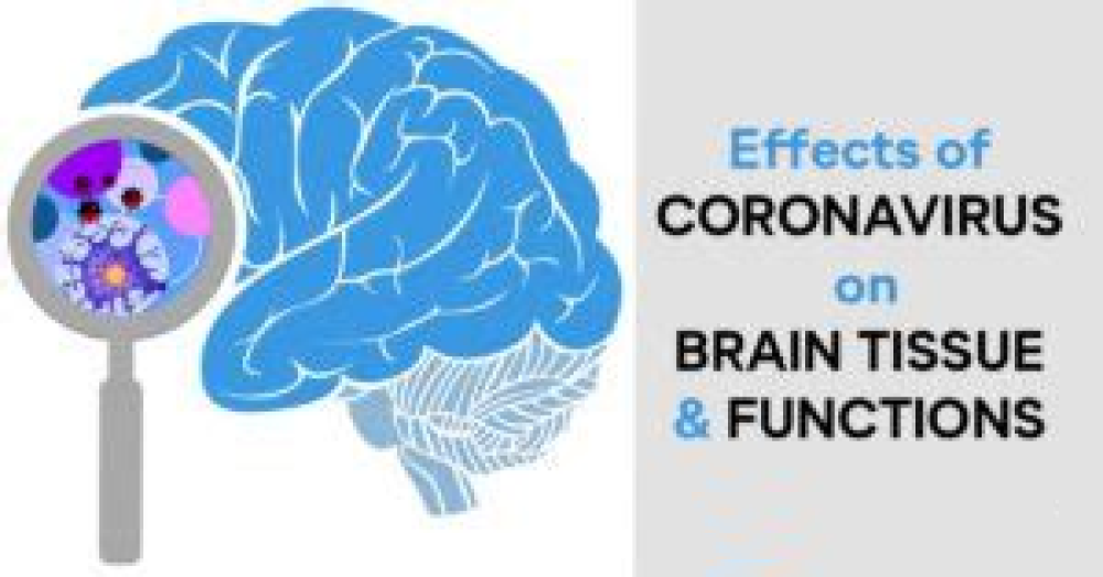 Neurologic Features in Severe SARS-CoV-2 Infection