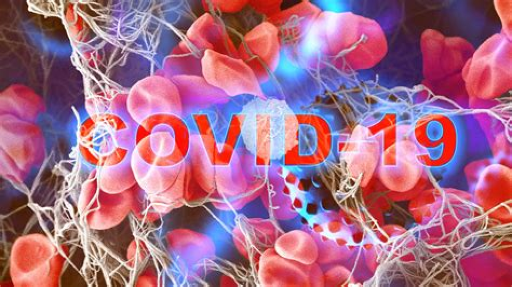 NIH study uncovers blood vessel damage and inflammation in COVID-19 patients’ brains but no infection