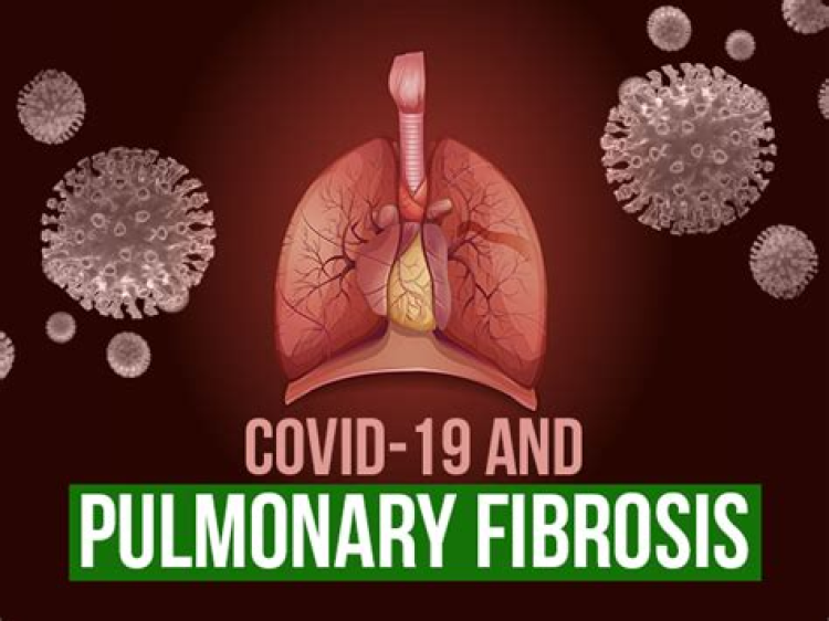 The characteristics and evolution of pulmonary fibrosis in COVID-19 patients as assessed by AI-assisted chest HRCT