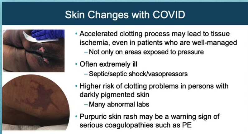 COVID-19: Cutaneous manifestations and issues related to dermatologic care