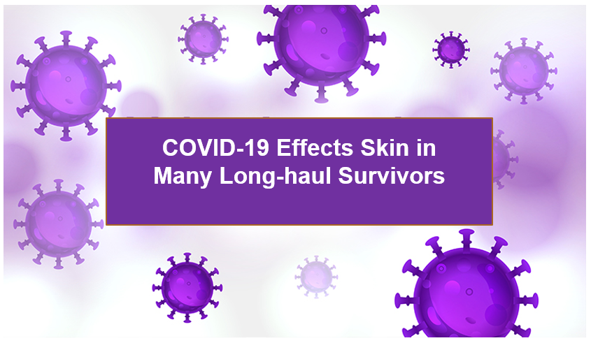 Skin Manifestations Associated with COVID-19: Current Knowledge and Future Perspectives