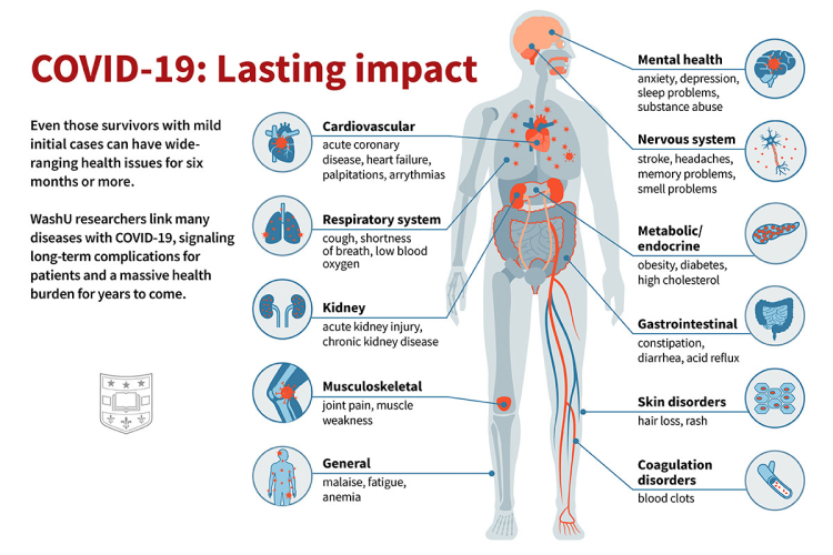 11 things doctors have learned about long COVID