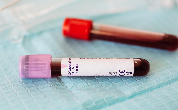 A blood test for long Covid is possible, a study suggests