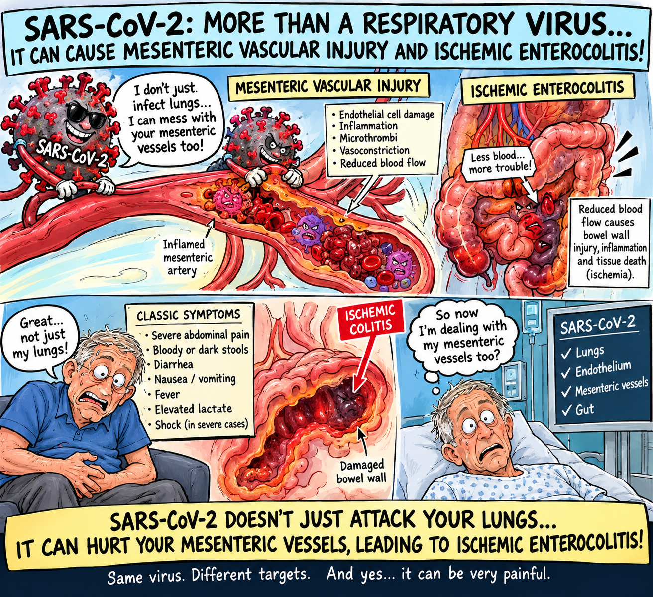 SARS-CoV-2, Mesenteric Vascular Injury and Ischemic Enterocolitis